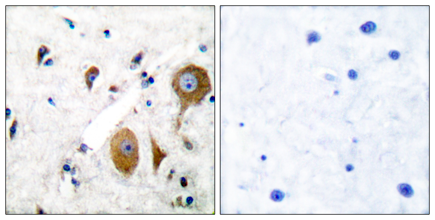 Anti-mGluR8 Antibody - Identical to Abcam (ab53094)
