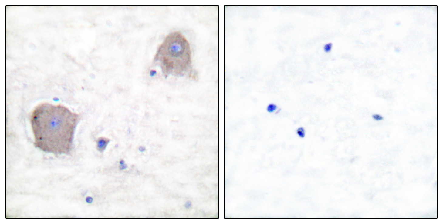 Anti-mGluR4 Antibody Anti-mGluR4 Antibody