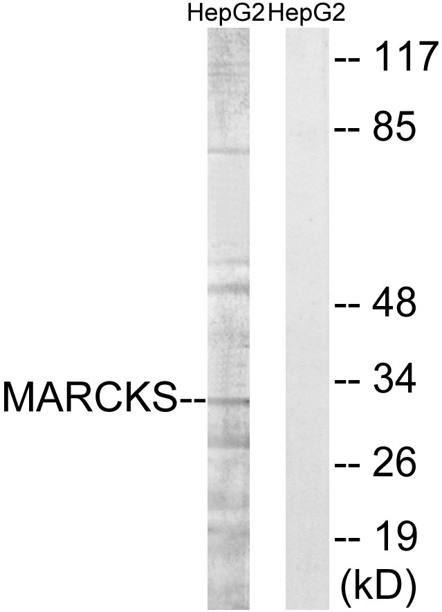 Anti-MARCKS Antibody - Identical to Abcam (ab51100)