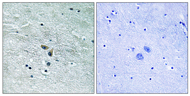 Anti-MAP3K8 Antibody - Identical to Abcam (ab196751) Anti-MAP3K8 Antibody - Identical to Abcam (ab196751)