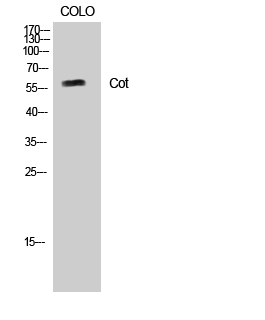 Anti-MAP3K8 Antibody - Identical to Abcam (ab196751) Anti-MAP3K8 Antibody - Identical to Abcam (ab196751)