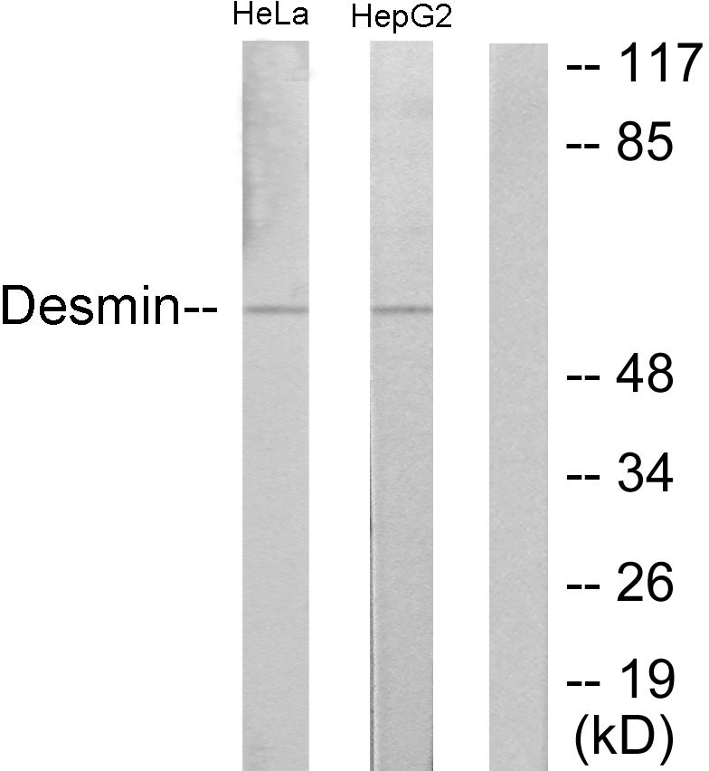 Anti-Desmin Antibody