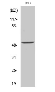 Anti-Desmin Antibody Anti-Desmin Antibody