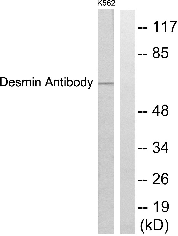 Anti-Desmin Antibody
