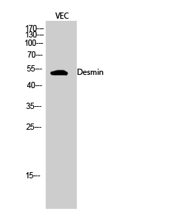 Anti-Desmin Antibody Anti-Desmin Antibody