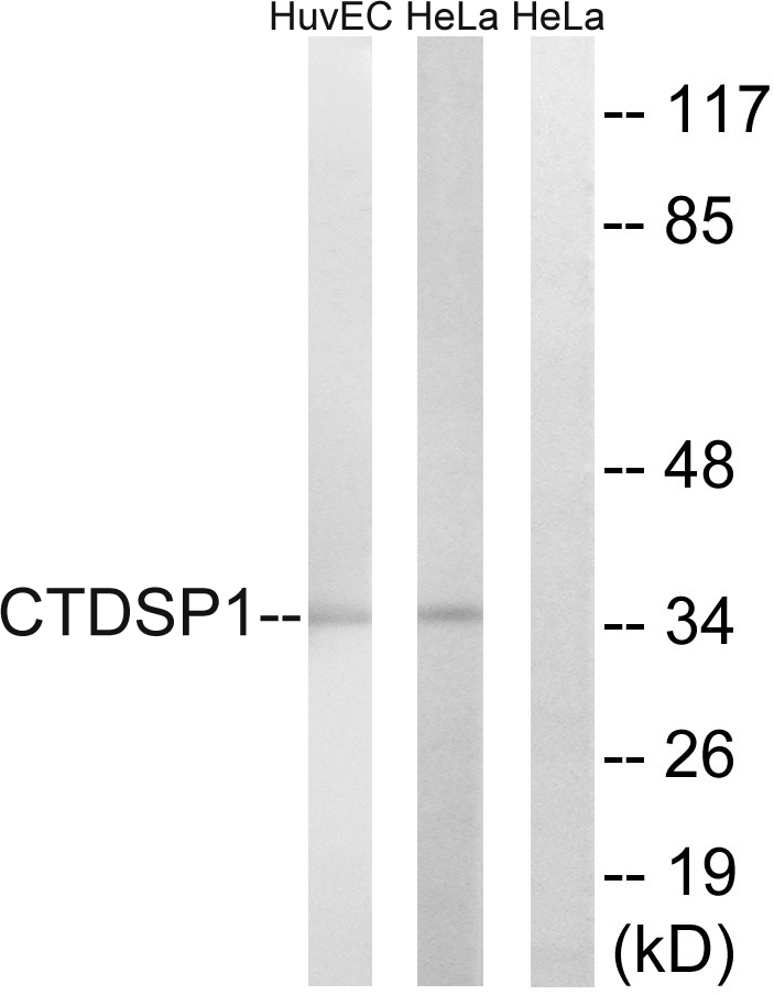 Anti-CTDSP1 Antibody