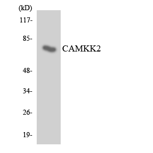 Anti-CAMKK2 Antibody