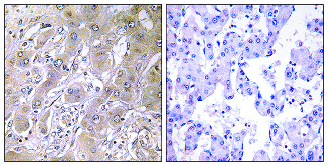 Anti-ACOT12 Antibody - Identical to Abcam (ab196783)