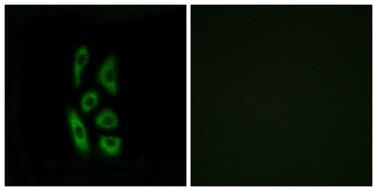 Anti-ACOT12 Antibody - Identical to Abcam (ab196783) Anti-ACOT12 Antibody - Identical to Abcam (ab196783)