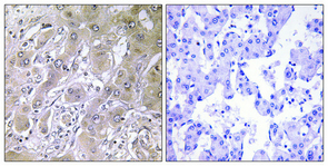 Anti-ACOT12 Antibody - Identical to Abcam (ab196783) Anti-ACOT12 Antibody - Identical to Abcam (ab196783)