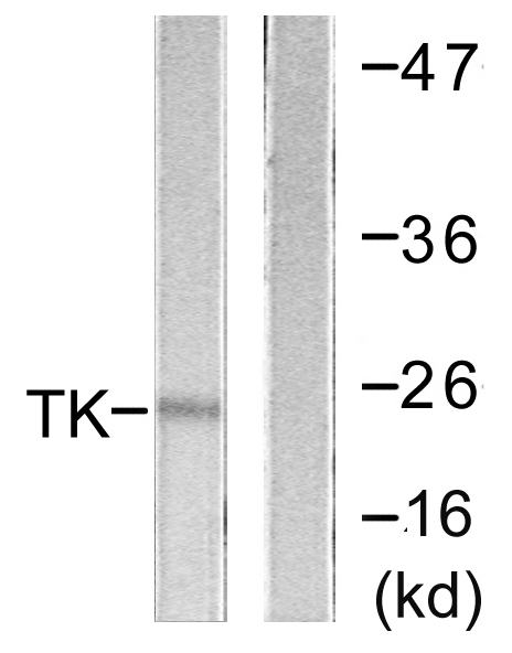 Anti-TK Antibody
