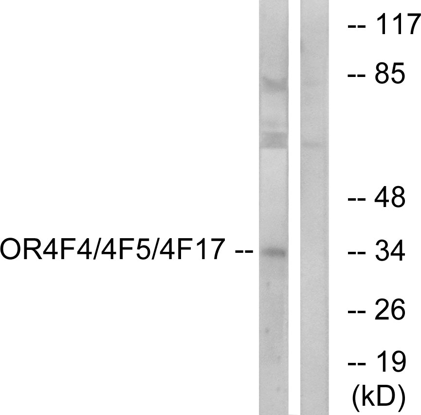 Anti-OR4F4 + OR4F5 + OR4F17 Antibody