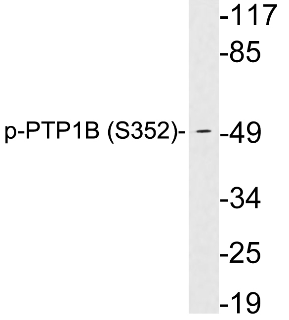 Anti-PTP1B (phospho Ser352) Antibody Anti-PTP1B (phospho Ser352) Antibody