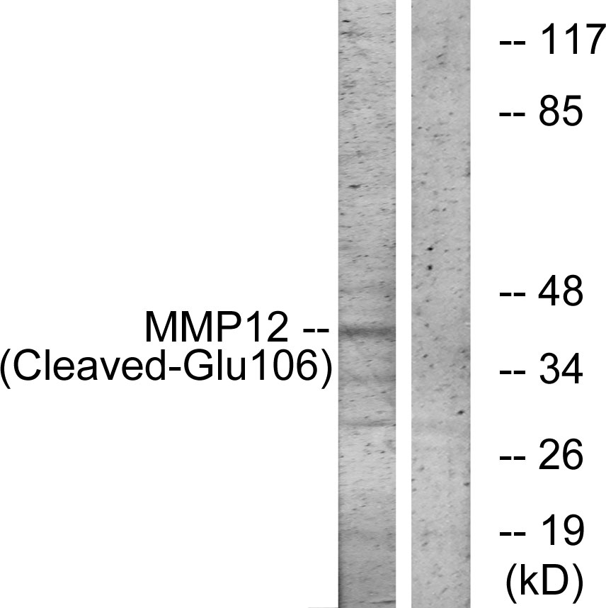 Anti-MMP12 (cleaved Glu106) Antibody