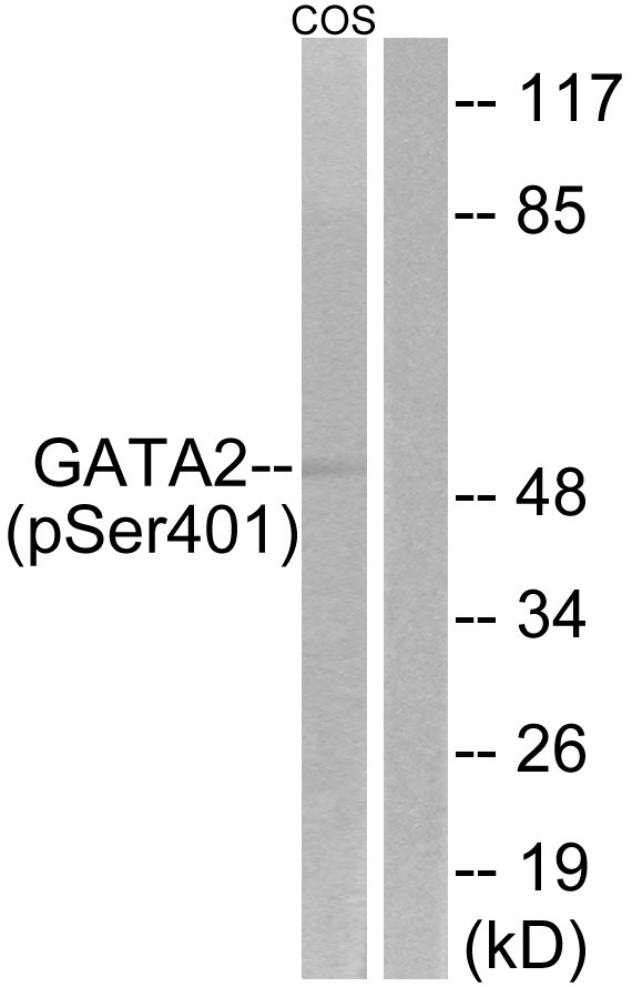Anti-GATA2 (phospho Ser401) Antibody