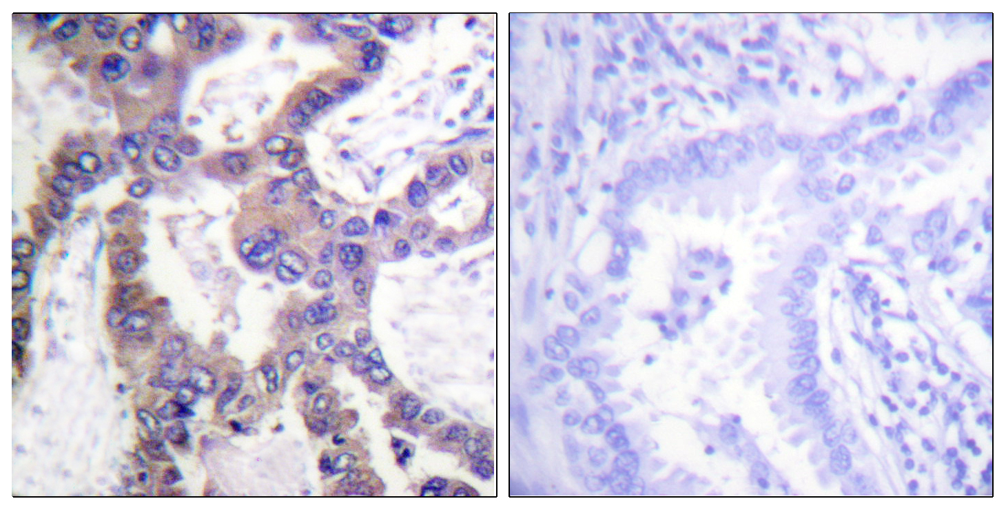 Anti-MKP1 (phospho Ser359) Antibody - Identical to Abcam (ab63548)
