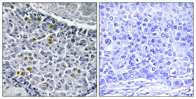 Anti-MAD1 (phospho Ser428) Antibody