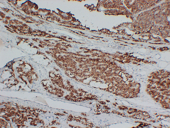 Anti-Parathyroid Hormone Antibody [ABT-PTH]