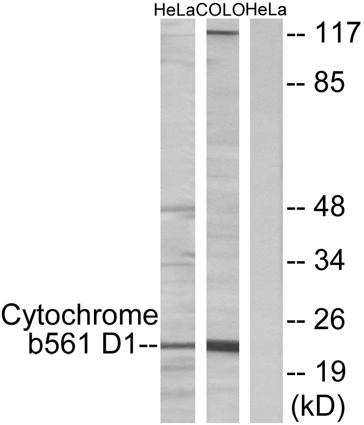 Anti-Cytochrome b561 D1 Antibody Anti-Cytochrome b561 D1 Antibody