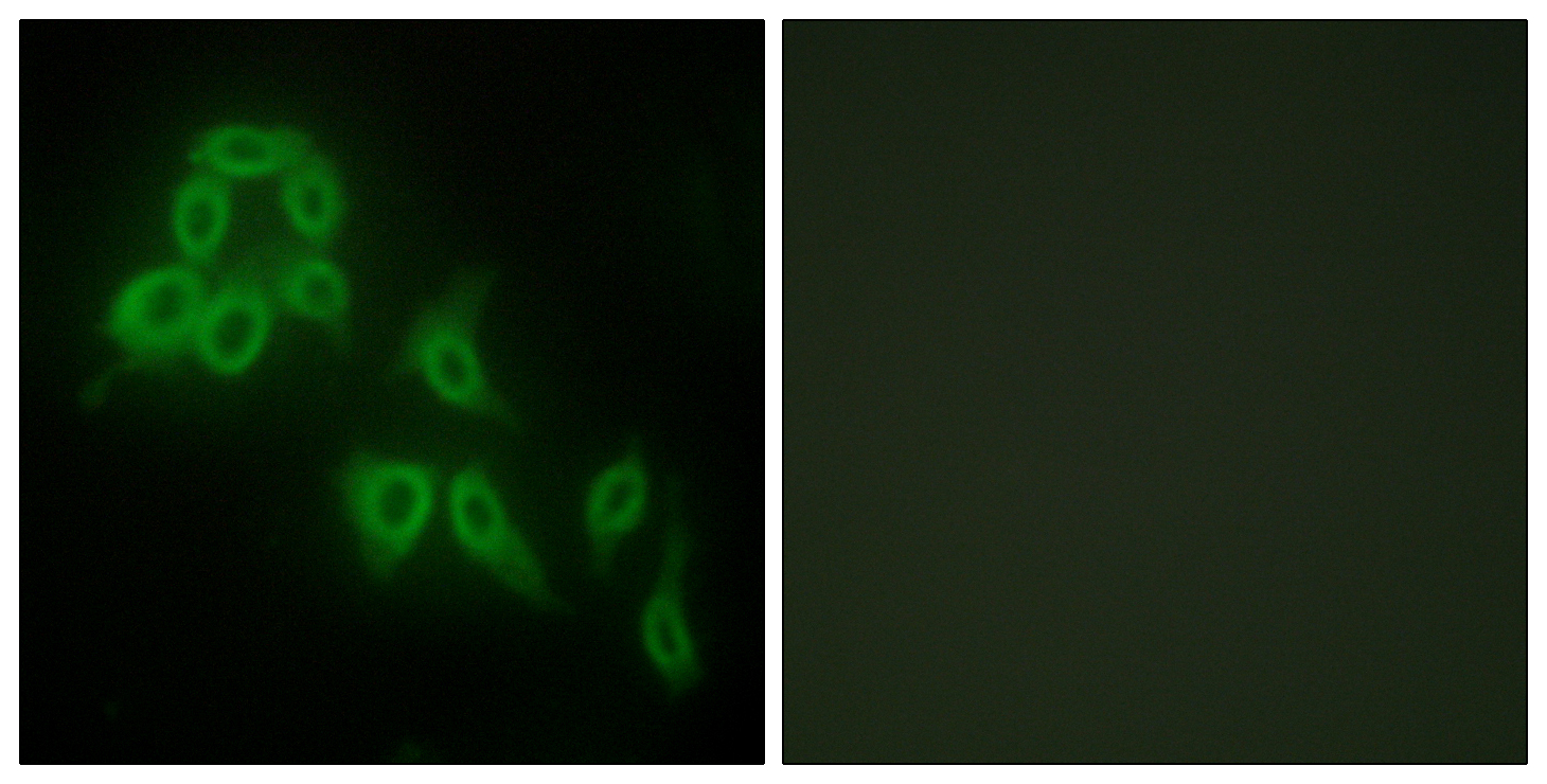 Anti-Collagen V alpha2 Antibody