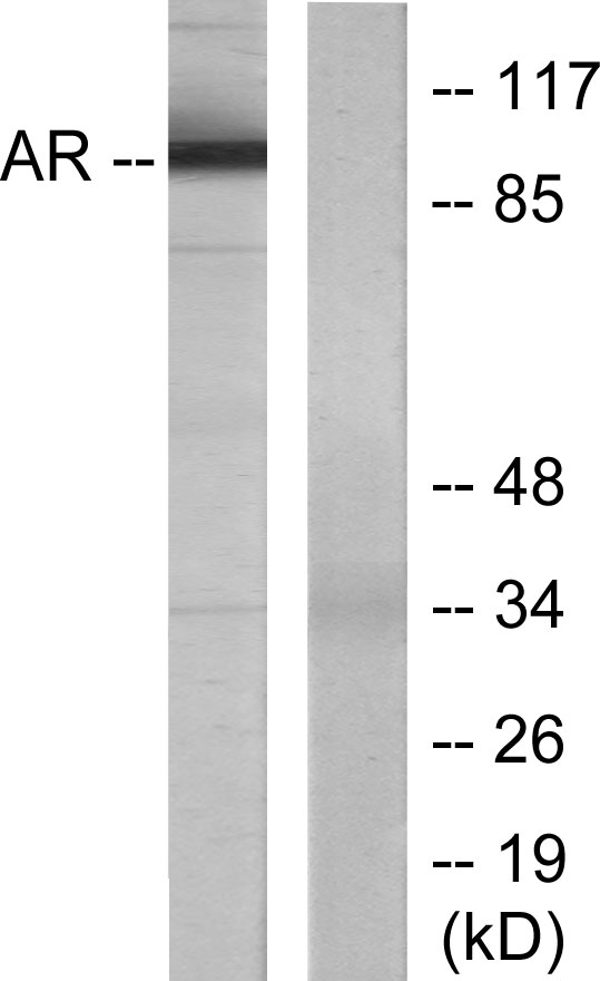 Anti-Androgen Receptor Antibody