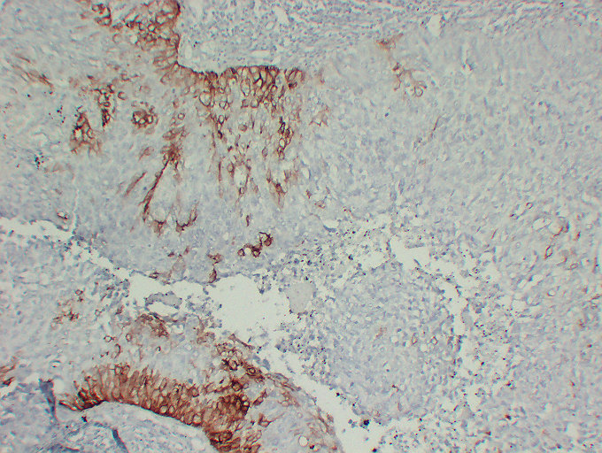 Anti-Cytokeratin 15 Antibody [ABT-CK15]