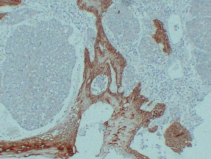 Anti-Cytokeratin 14 Antibody [ABT-CK14]