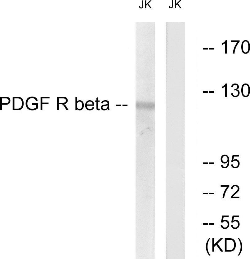 Anti-PDGFR beta Antibody