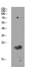 Anti-Claudin 11 Antibody Anti-Claudin 11 Antibody