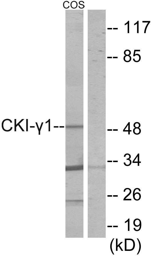 Anti-CKI-gamma1 Antibody
