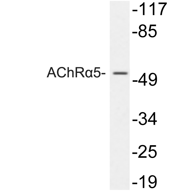 Anti-AChRalpha5 Antibody
