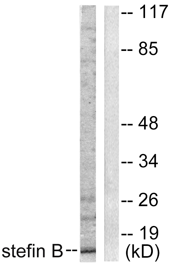 Anti-Stefin B Antibody
