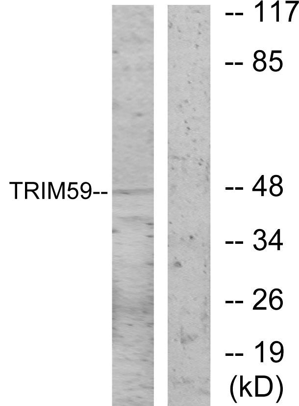 Anti-TRIM59 Antibody