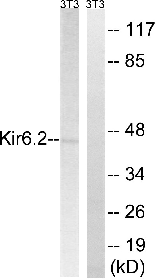 Anti-Kir6.2 Antibody - Identical to Abcam (ab139389)
