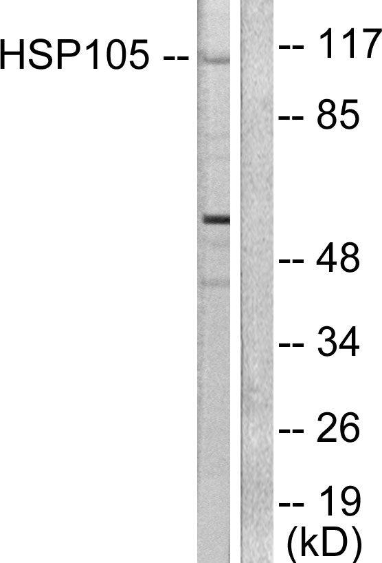 Anti-HSP105 Antibody - Identical to Abcam (ab166780)