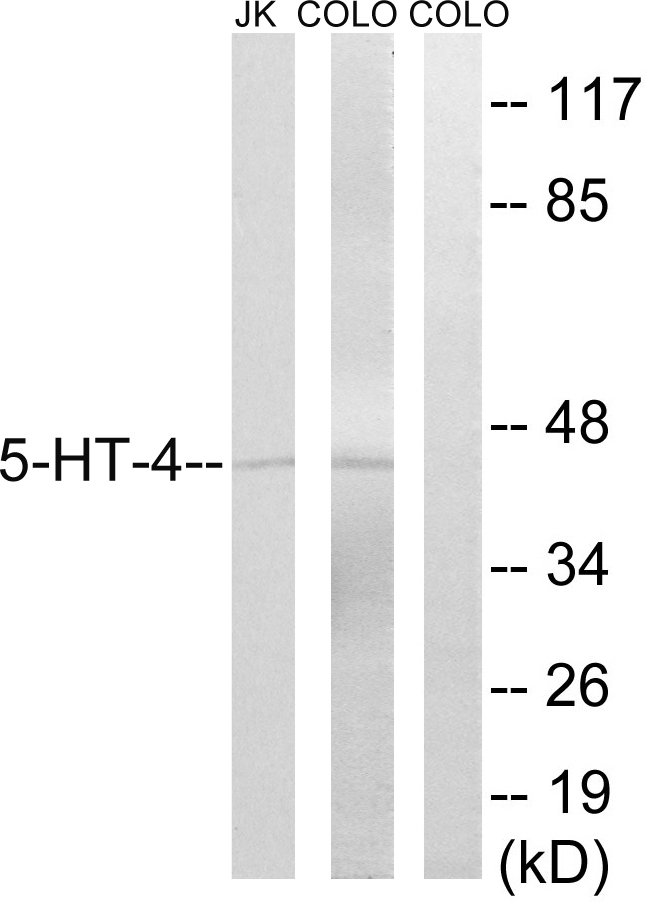 Anti-5-HT-4 Antibody - Identical to Abcam (ab60359)