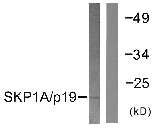 Anti-SKP1A Antibody