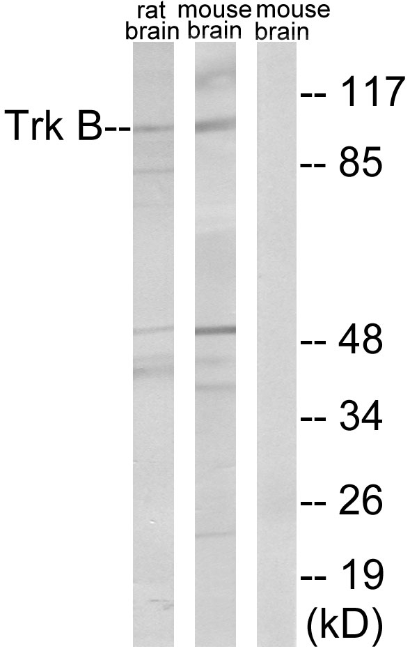 Anti-Trk B Antibody