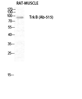 Anti-Trk B Antibody Anti-Trk B Antibody