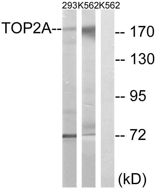 Anti-TOP2A Antibody