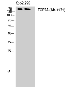 Anti-TOP2A Antibody Anti-TOP2A Antibody