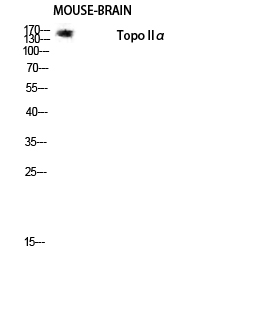 Anti-TOP2A Antibody Anti-TOP2A Antibody