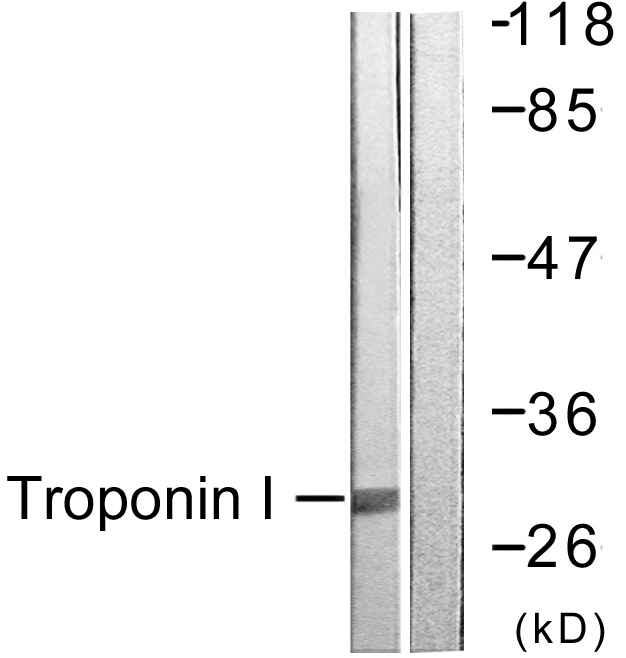 Anti-TNNI3 Antibody