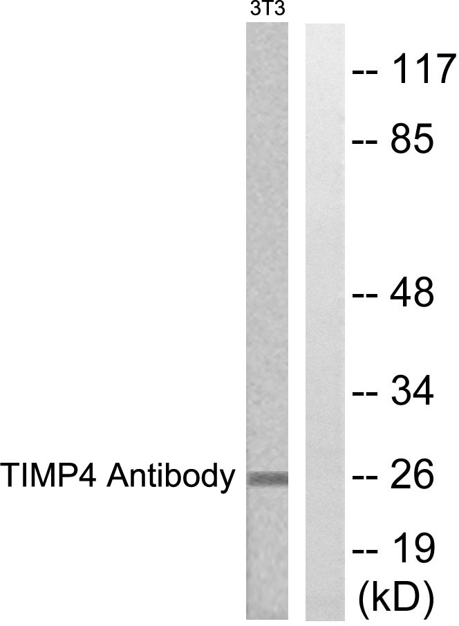 Anti-TIMP4 Antibody - Identical to Abcam (ab58425)