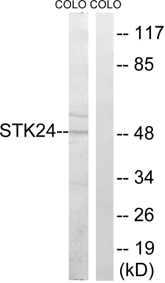 Anti-STK24 Antibody