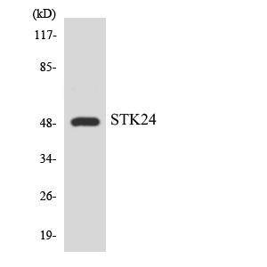 Anti-STK24 Antibody