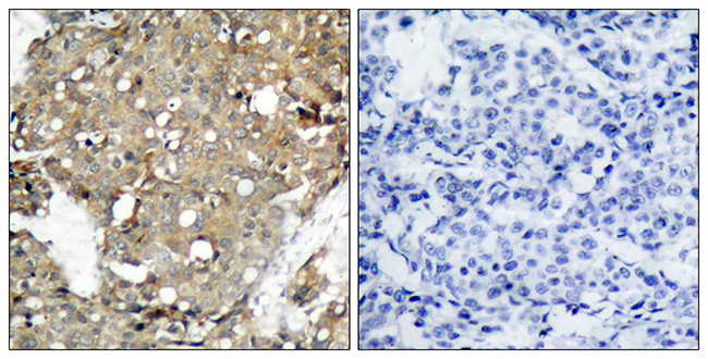 Anti-STAT1 Antibody - Identical to Abcam (ab47425) Anti-STAT1 Antibody - Identical to Abcam (ab47425)