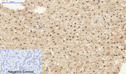 Anti-STAT1 Antibody - Identical to Abcam (ab47425) Anti-STAT1 Antibody - Identical to Abcam (ab47425)