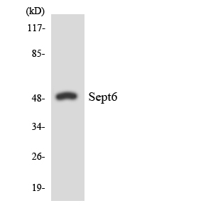 Anti-SEPT6 Antibody