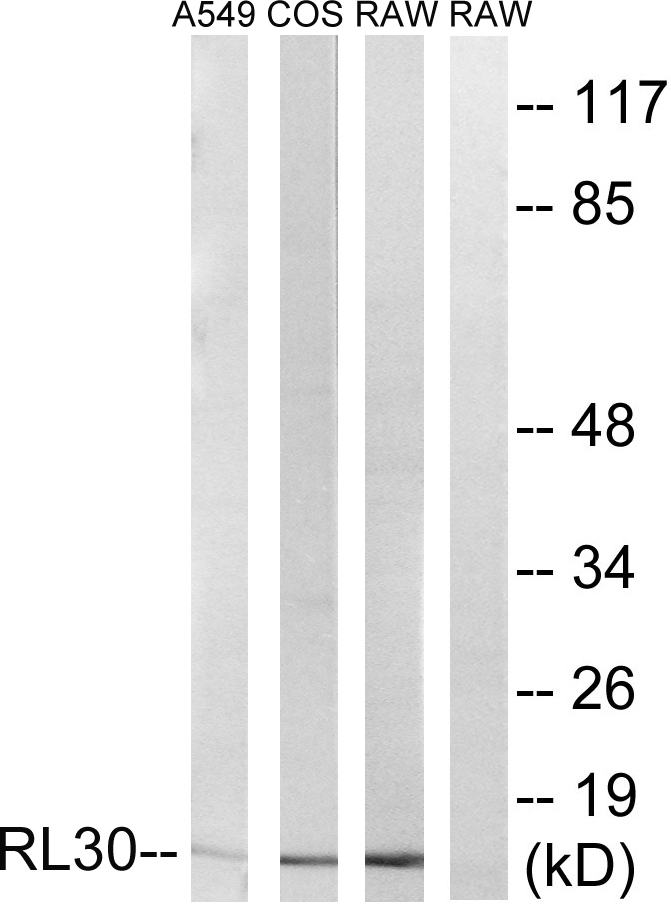 Anti-RPL30 Antibody